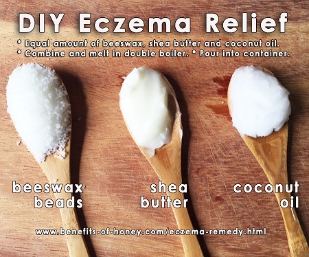 Natural Eczema Remedy with Beeswax image