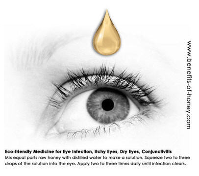 honey eye eyes infection cure benefits drops water manuka vision treatment pink hours corneal distilled