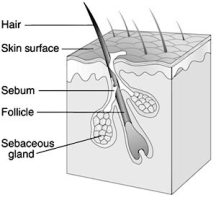 acne image