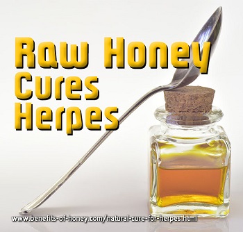 honey cure for herpes image