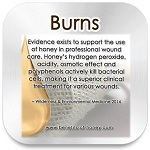 honey burn remedy