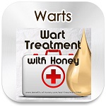 warts honey treatment