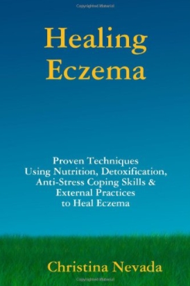 Amazon Book Healing Eczema