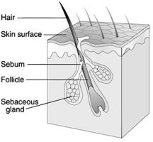 acne remedy with honey