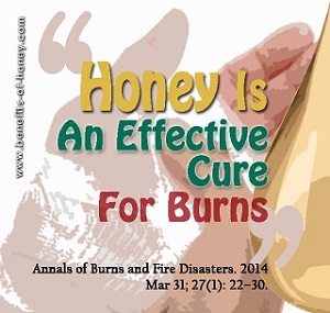how to treat a burn effectively with honey poster