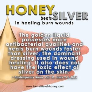 honey is number one burn treatment
