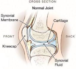 arthritis pain joints diagram